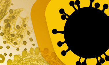 Abstract illustration of SARS-CoV-2, the virus that causes COVID-19, in shades of yellow, brown, and black