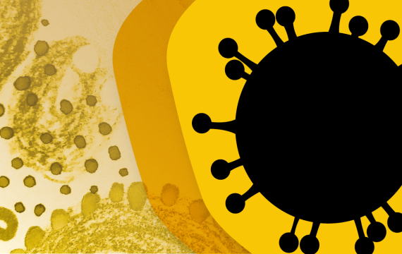 Abstract illustration of SARS-CoV-2, the virus that causes COVID-19, in shades of yellow, brown, and black
